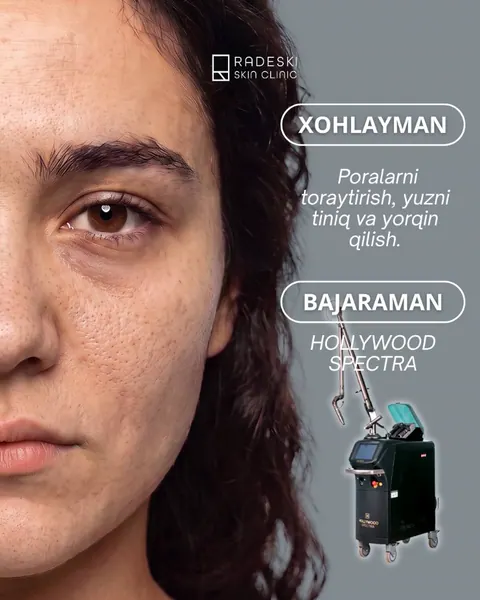 Hollywood Spectra (Lutronic) in Fergana and Kokand