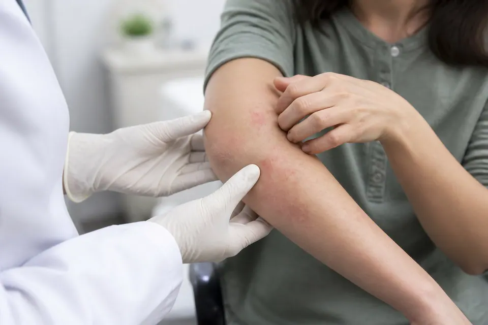 Itchy Skin: Causes, Warning Signs and Treatment — Why Your Skin Itches