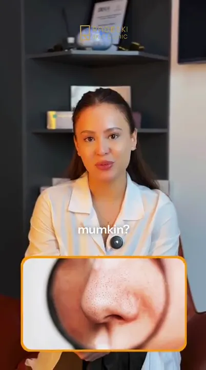 Keep your cosmetologist’s advice — and leave blackheads behind